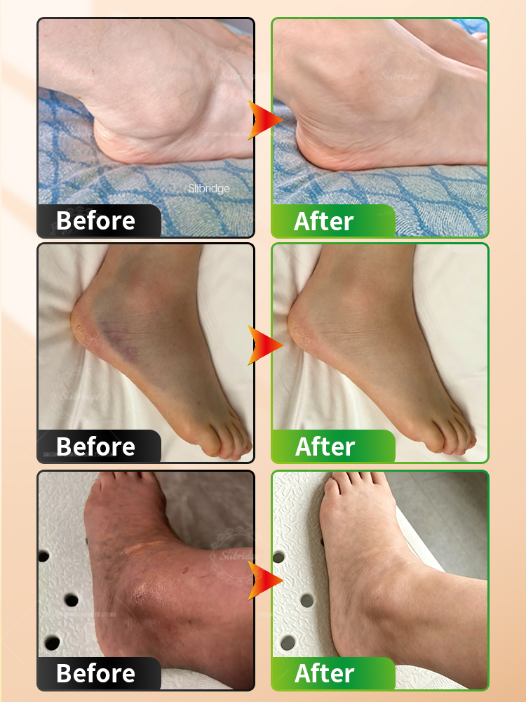 Elektrikli Ayak Bileği Masaj A - Ankle Brace Support incelemesi ve fiyatı